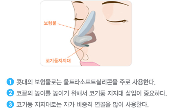 1. 콧대의 보형물로는 울트라소프트실리콘을 주로 사용한다. 
2. 코끝의 높이를 높이기 위해서 코기둥 지지대 삽입이 중요하다. 
3. 코기둥 지지대로는 자가 비중격 연골을 많이 사용한다.