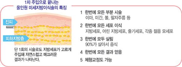 1차 주입으로 끝나는 올인원 미세지방이식술의 특징